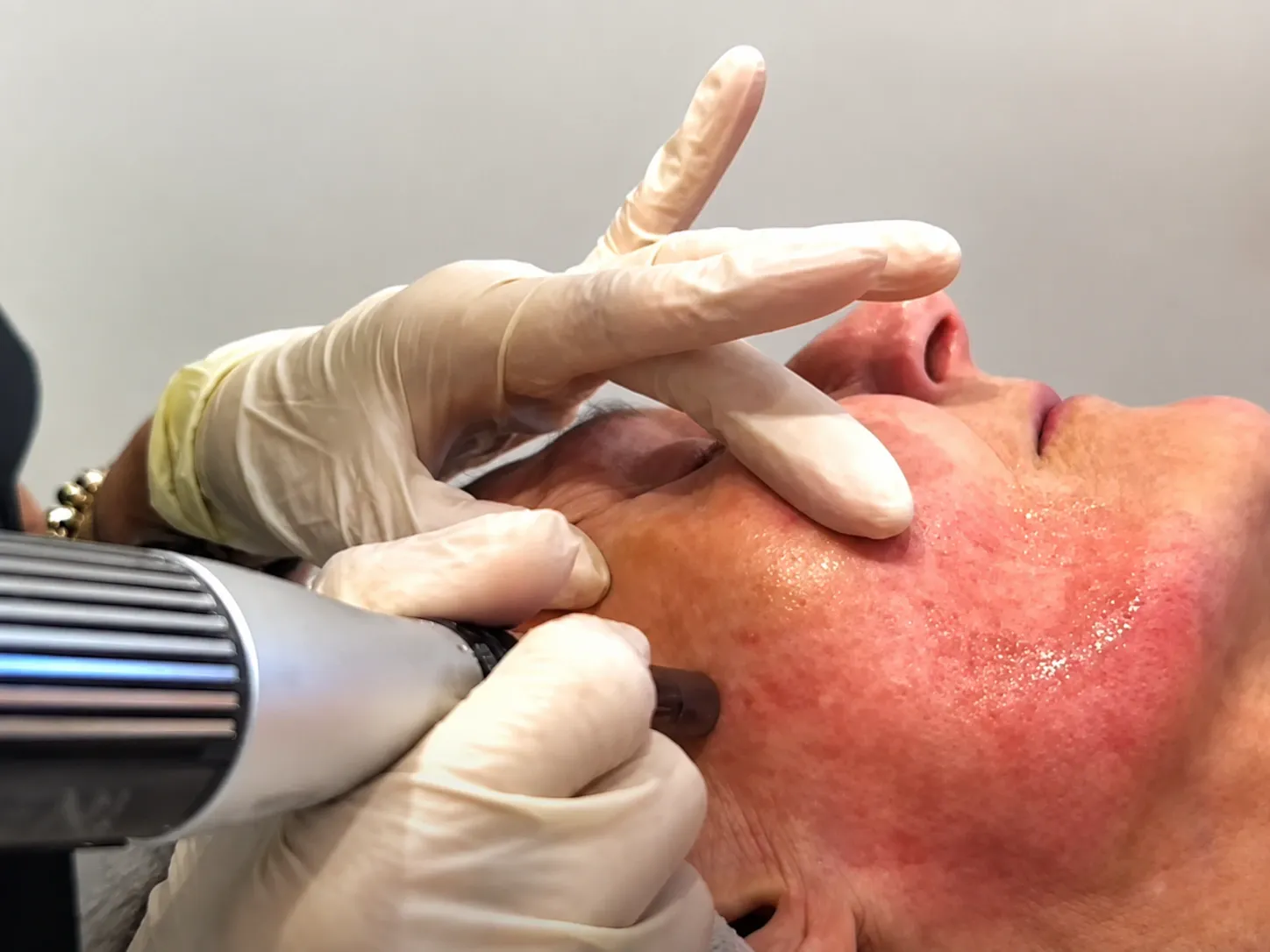 Professional facial skin treatment at The Beautician